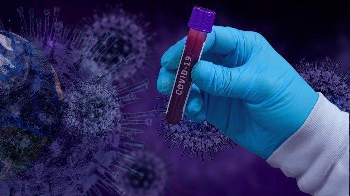 Ketua Komisi VI Klarifikasi Kabar RI Gagal Beli Vaksin Sinopharm-AstraZeneca Gara-gara Terawan